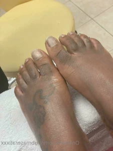 15570651