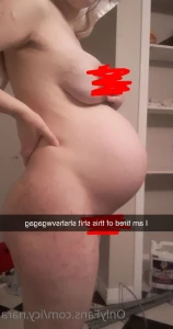 7607931