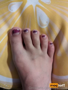 15556653