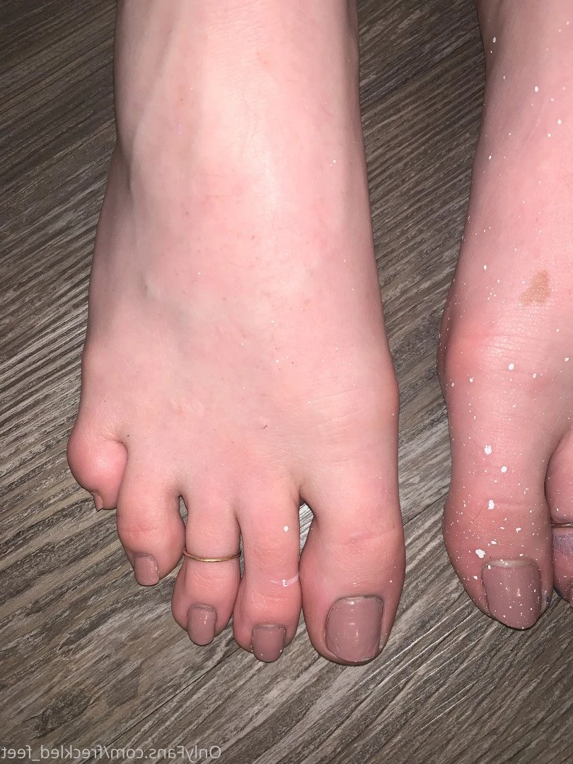 Freckled Feet [ freckled_feet ] Onlyfans leaked photo 5069974 on Hotleaks.tv