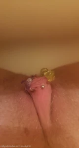 5570607