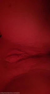 5570628