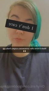 5765887