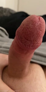 5732293