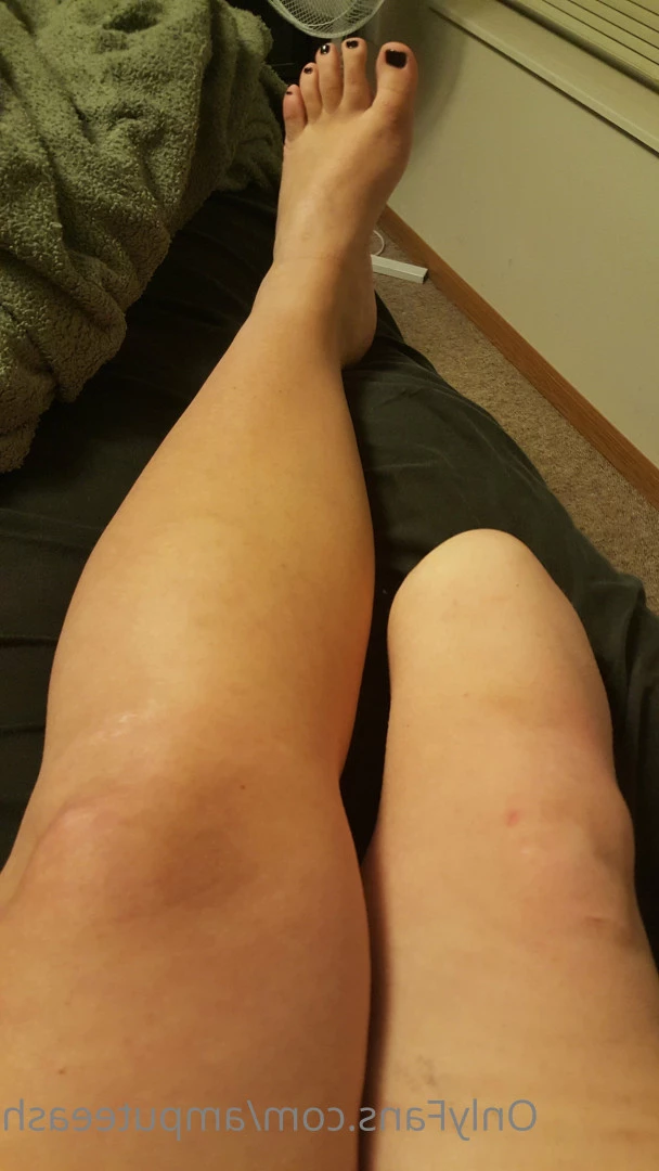 amputeeash Onlyfans leaked photo 7652114 on Hotleaks.tv