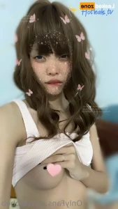 15460315