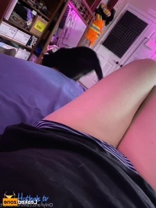 15651455