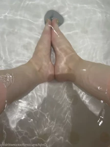 7660705