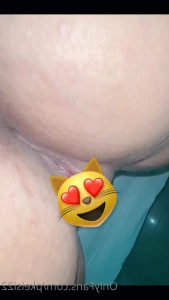 7145076