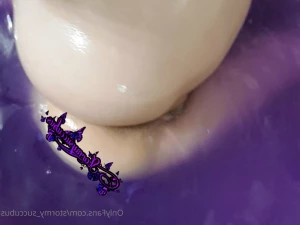 7035578