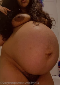 10422658