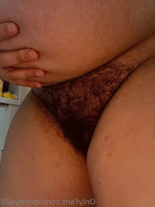 10422709
