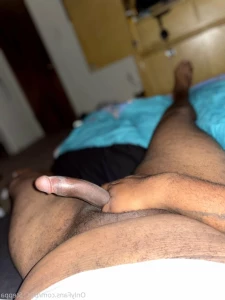 14781423