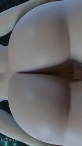 8666472
