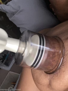 14223512