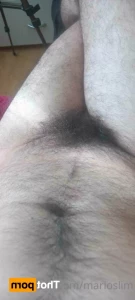 14931644