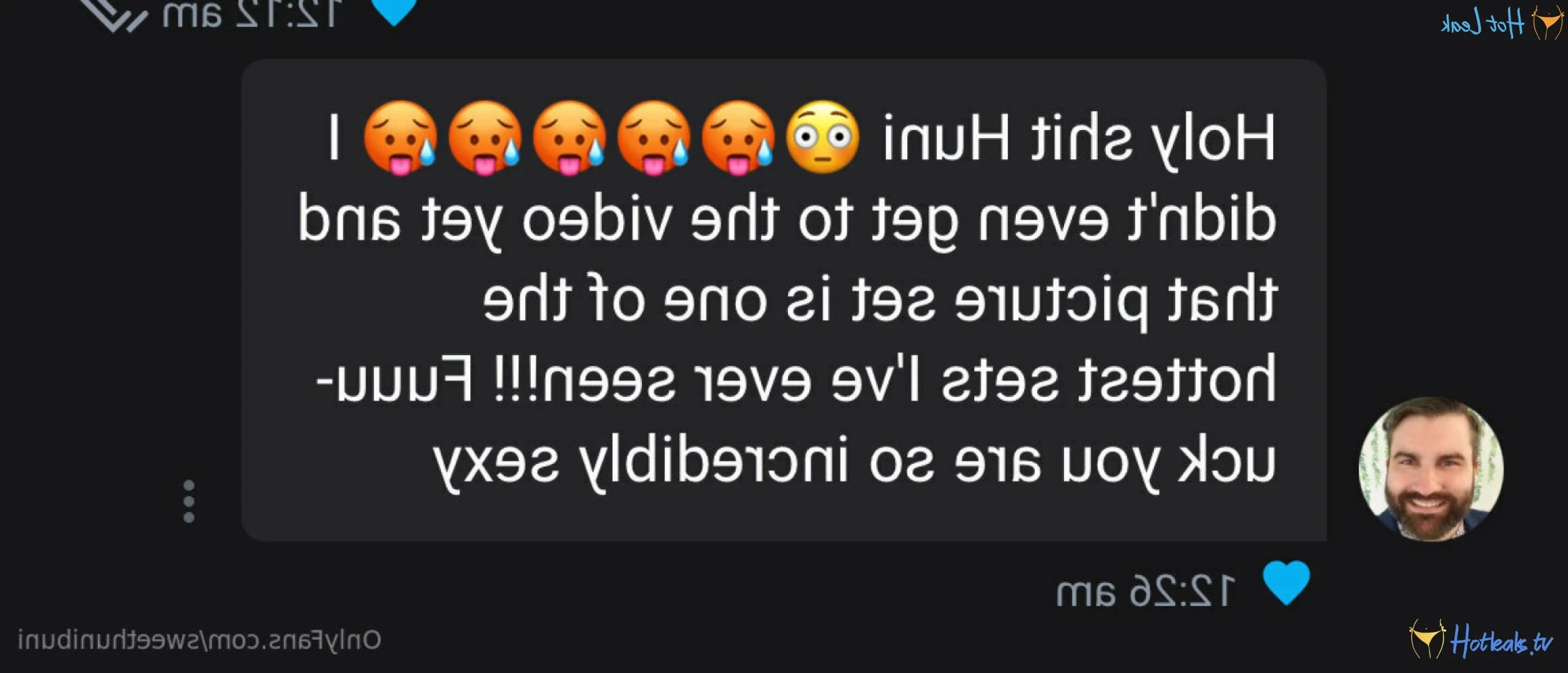 🐰Huni Buni🐰 [ xo_lilhuni_xo ] Onlyfans leaked photo 12333416 on Hotleaks.tv