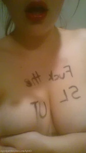 15618431
