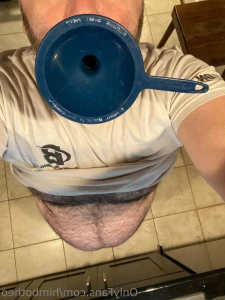 11397677