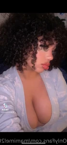 15640712