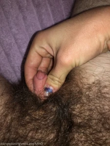 14031799