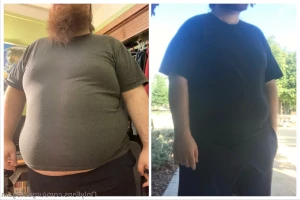 15573442