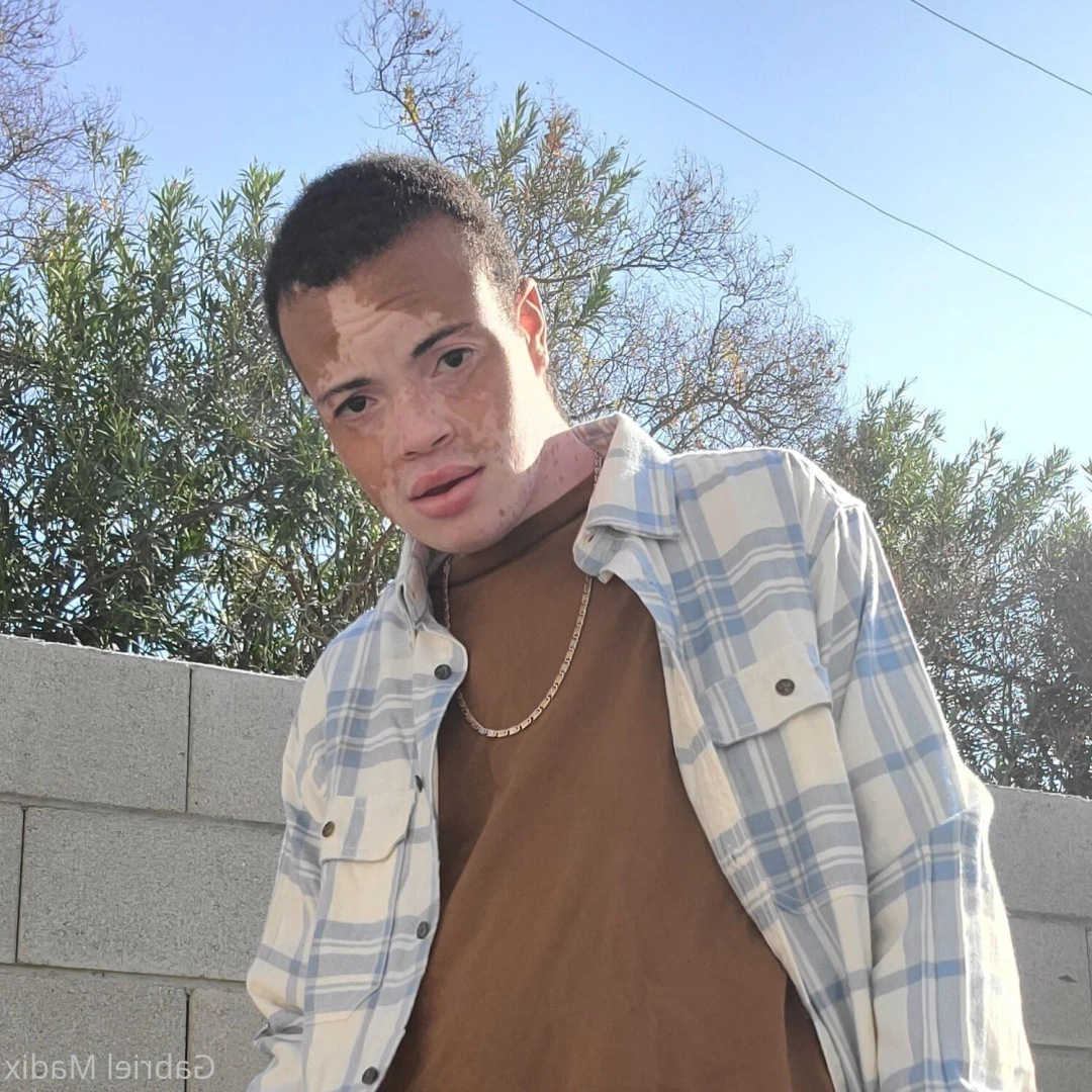 Gabriel [ vitiligoftmboi ] Onlyfans leaked photo 17684431 on Hotleaks.tv