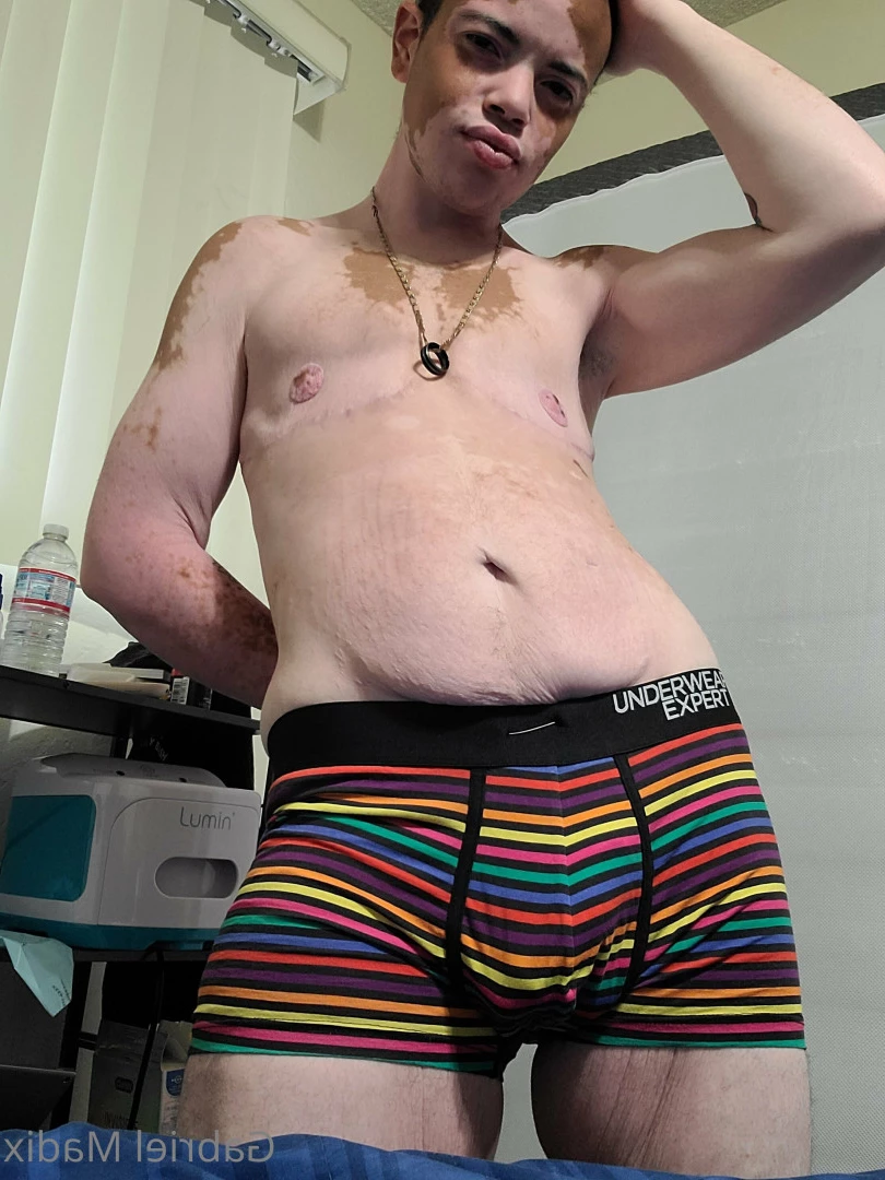 Gabriel [ vitiligoftmboi ] Onlyfans leaked photo 17684521 on Hotleaks.tv