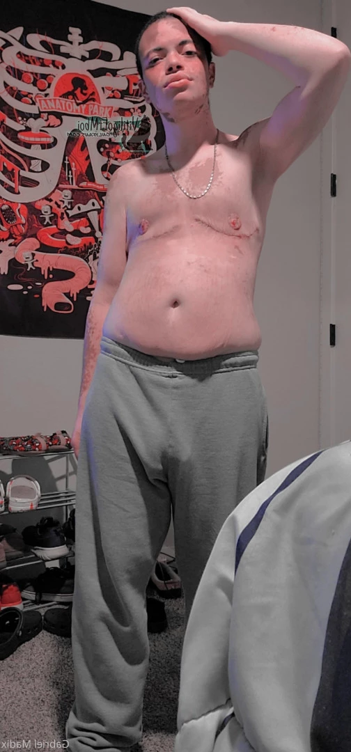 Gabriel [ vitiligoftmboi ] Onlyfans leaked photo 17684527 on Hotleaks.tv