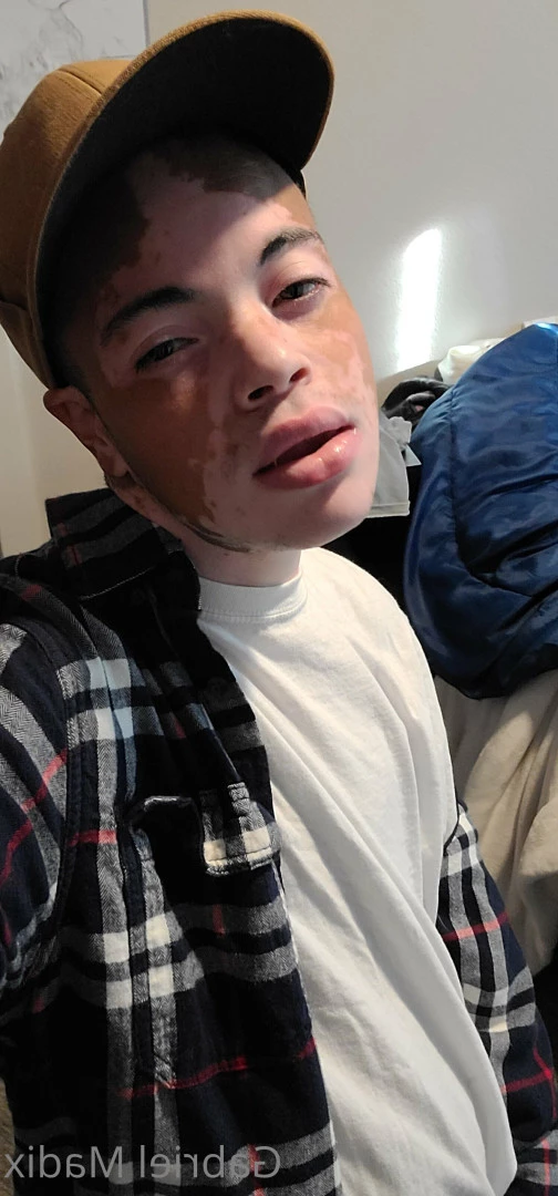Gabriel [ vitiligoftmboi ] Onlyfans leaked photo 17684550 on Hotleaks.tv