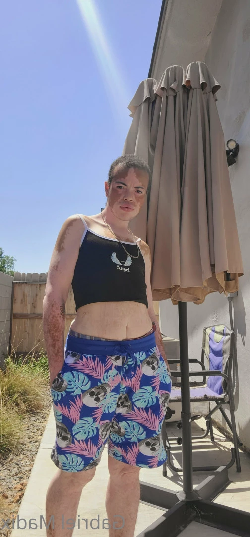 Gabriel [ vitiligoftmboi ] Onlyfans leaked photo 17684596 on Hotleaks.tv