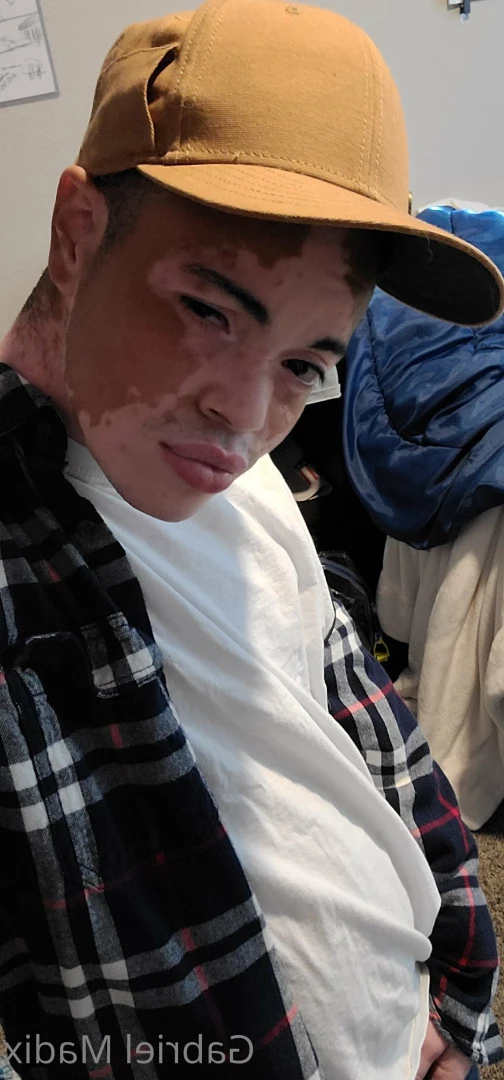 Gabriel [ vitiligoftmboi ] Onlyfans leaked photo 17684610 on Hotleaks.tv