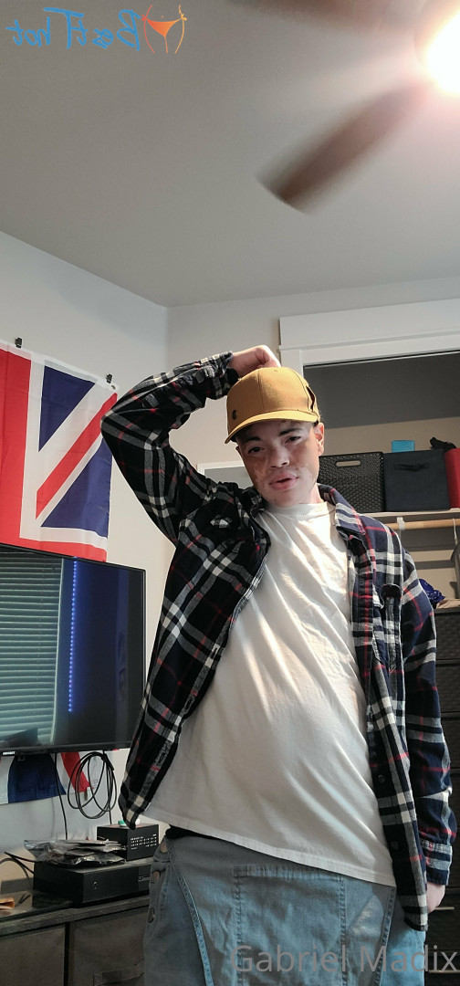 Gabriel [ vitiligoftmboi ] Onlyfans leaked photo 17684634 on Hotleaks.tv