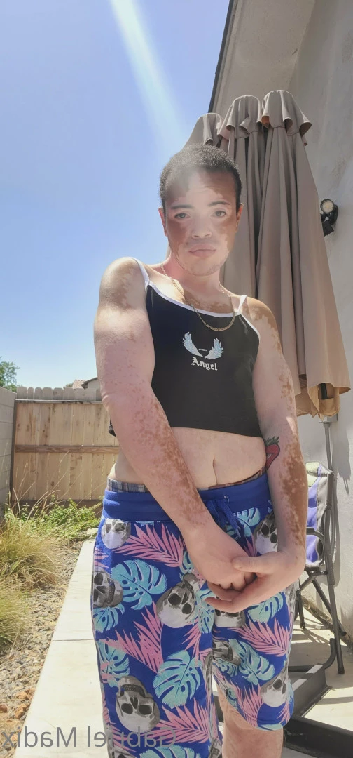 Gabriel [ vitiligoftmboi ] Onlyfans leaked photo 17684646 on Hotleaks.tv