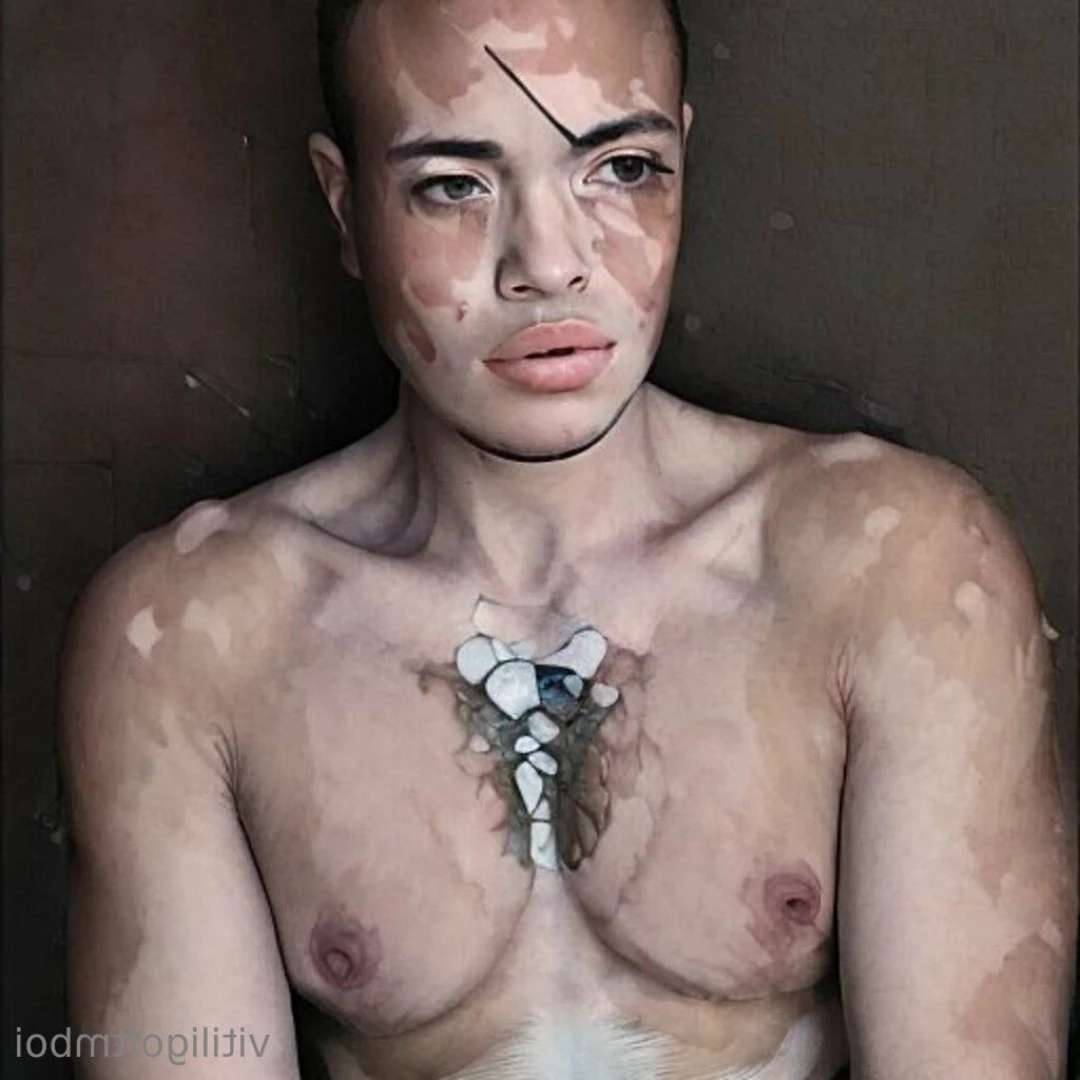 Gabriel [ vitiligoftmboi ] Onlyfans leaked photo 17684653 on Hotleaks.tv