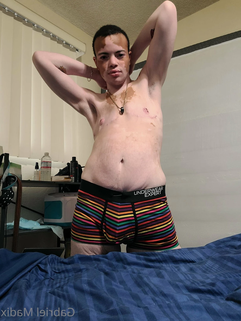 Gabriel [ vitiligoftmboi ] Onlyfans leaked photo 17684722 on Hotleaks.tv