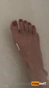 15571244