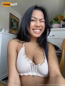 15237886
