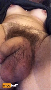16404929