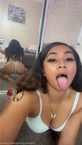 17779478