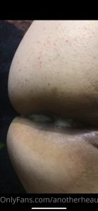 18673436